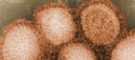 В Днепропетровске подтверждены 3 случая заболевания свиным гриппом. Видео