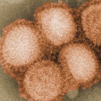 В Днепропетровской области от свиного гриппа умерли 6 человек